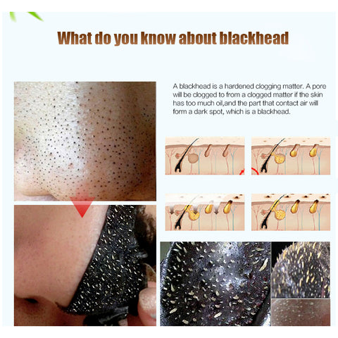 charcoal black mask to remove blackhead