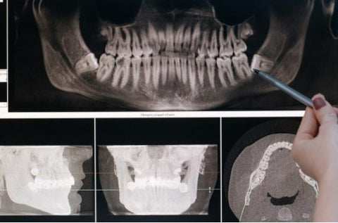 Dental provider can evaluate the level of the bone as well as see if there's any tartar below the gum line that needs attention. | Cheeeese