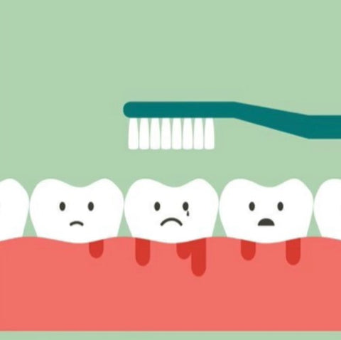 Inadequate brushing and flossing cause dental plaque | Cheeeese