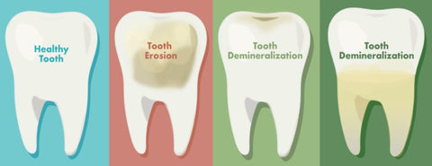 Enamel erosion can be caused by eating a highly acidic diet, brushing your teeth too hard, and other factors. | Cheeeese 