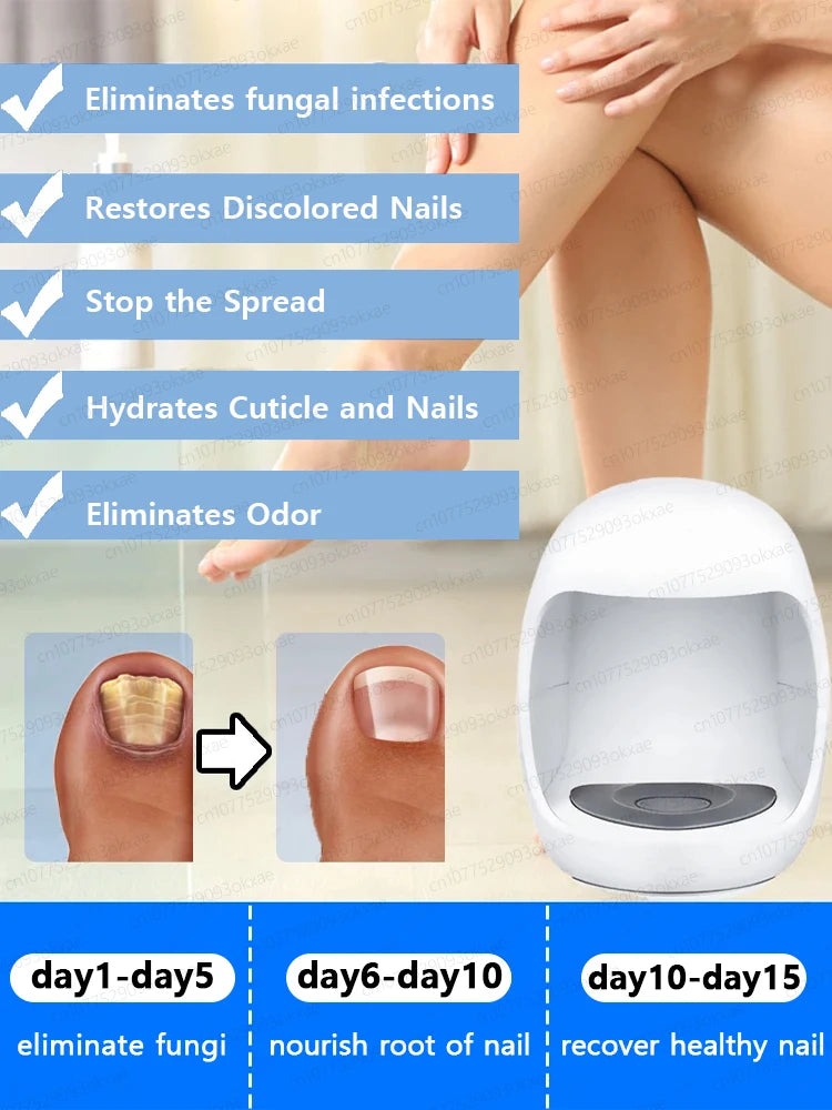 Fungal Nail Laser Device Repair Nails Fungus Onychomycosis