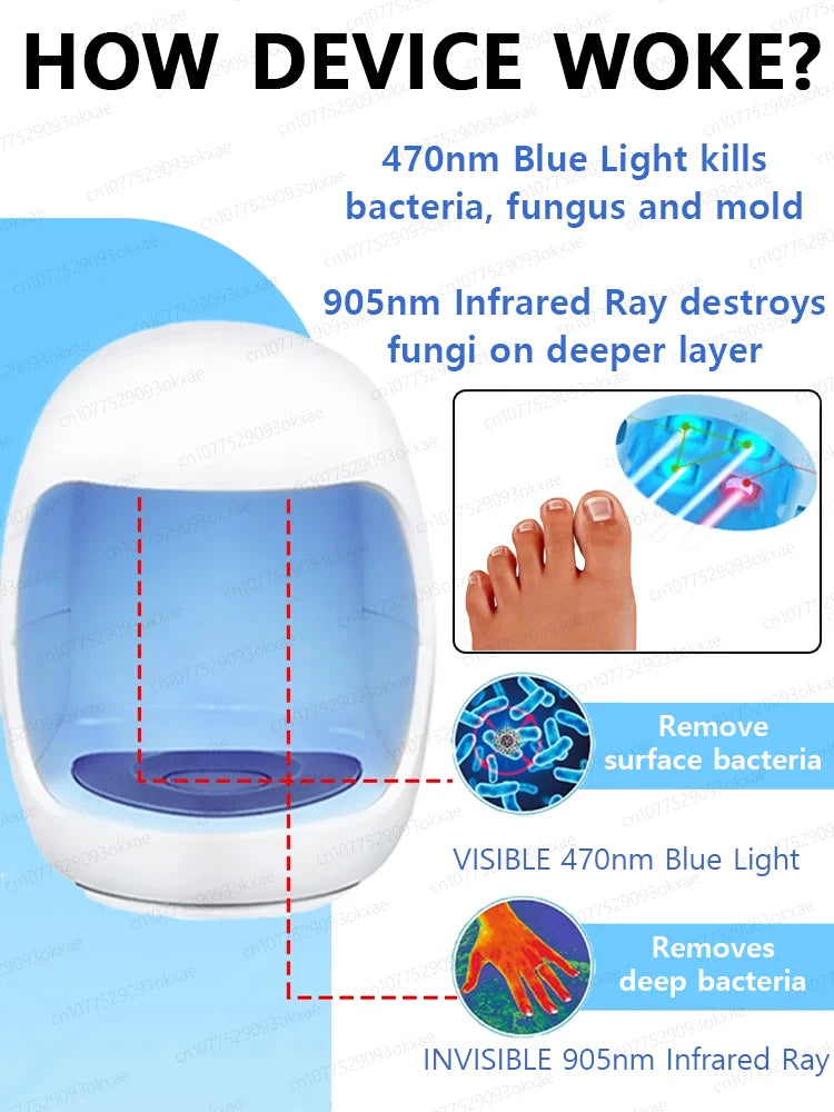 Fungal Nail Laser Device Repair Nails Fungus Onychomycosis