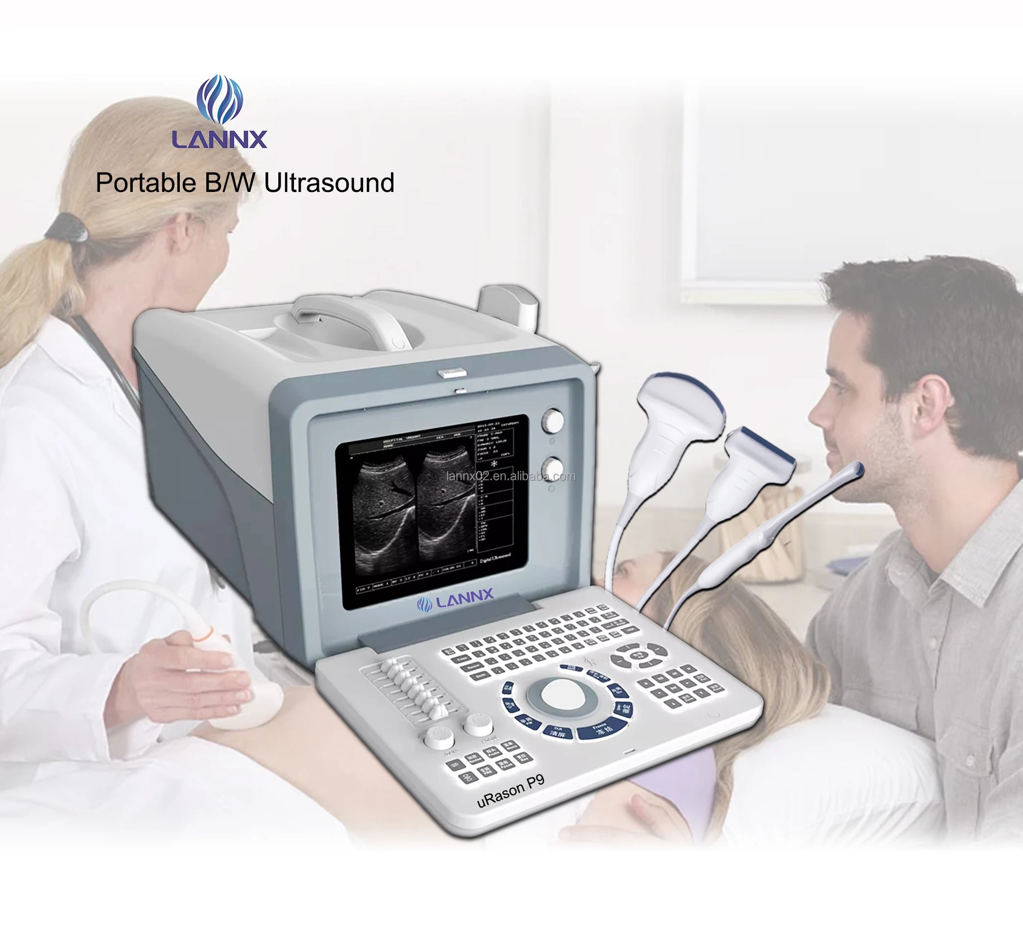 Portable ultrasound scanner for human being I laptop black/white ultrasound Machine