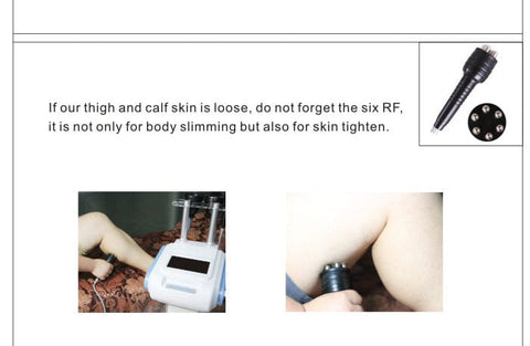 unoisetion cavitation rf treatment