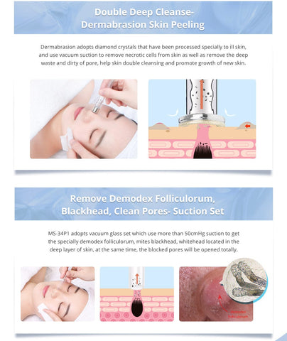 Dermabrasion-Facial-Peel