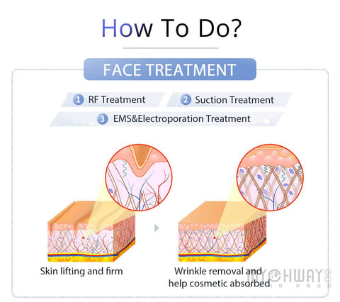 suction treatment