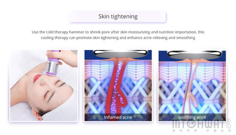 skin treatment beauty machine