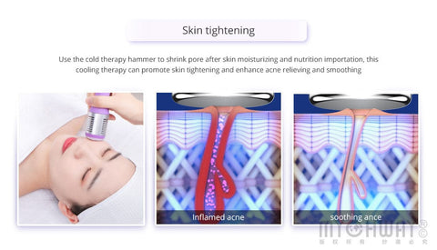 skin rejuvenation