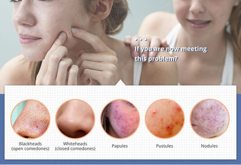 electric face scrubber