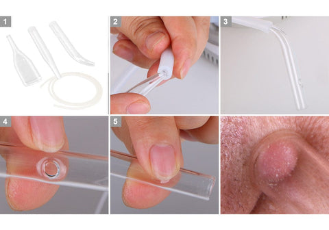 Skin Care Microdermabrasion Machine