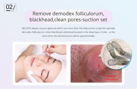 Diamond Dermabrasion