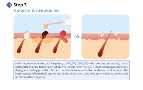 diamond dermabrasion treatment
