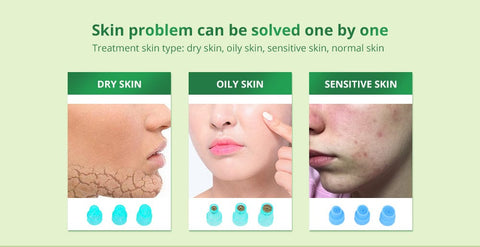 acne treatment