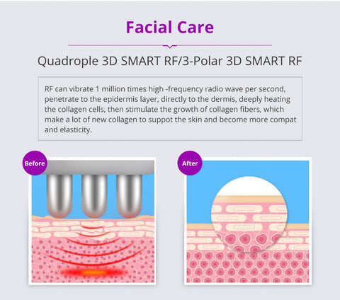 rf cavitation machine