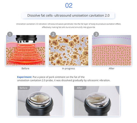 cellulite reduce