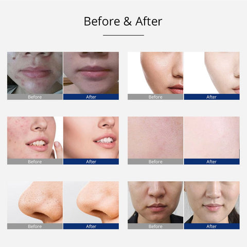 skin care
