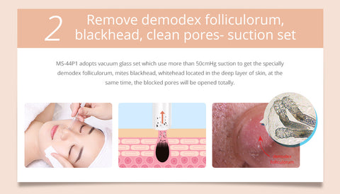 microdermabrasion at-home