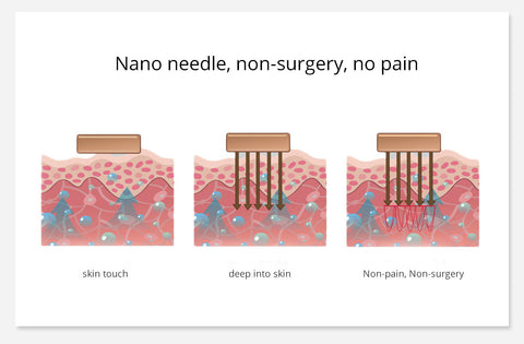 nano needle