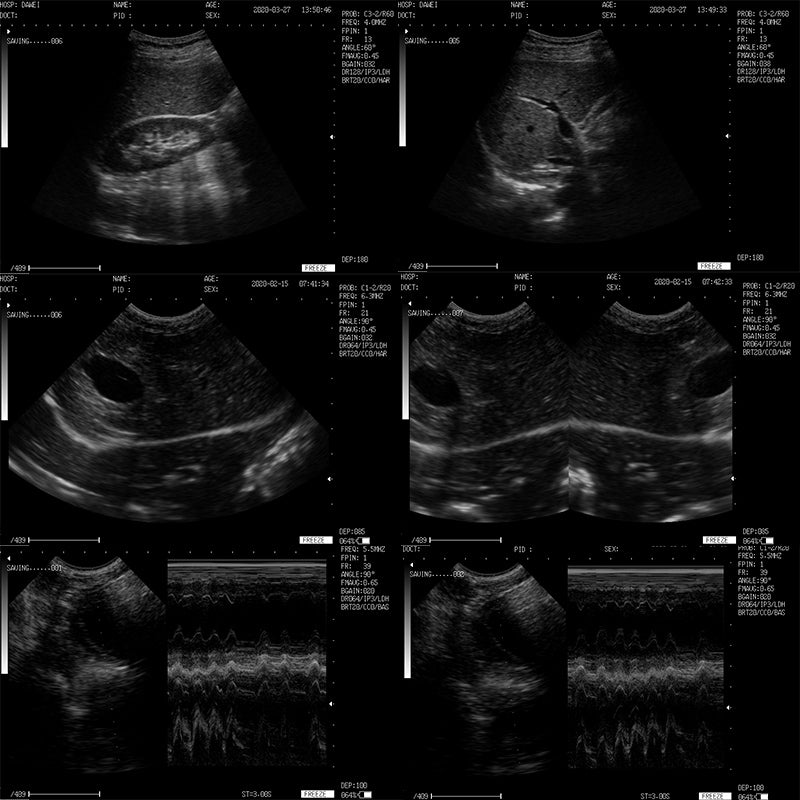 DW-500 Clinical image