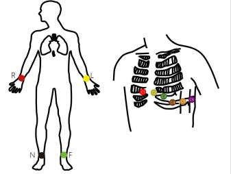 How to connect lead cables?