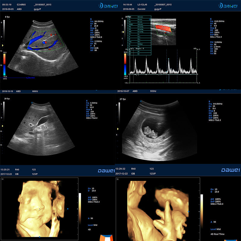 P6 Image clinique