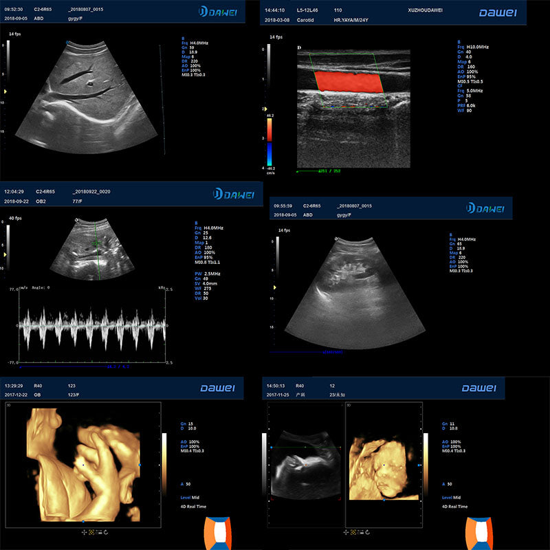 T6 Clinical image