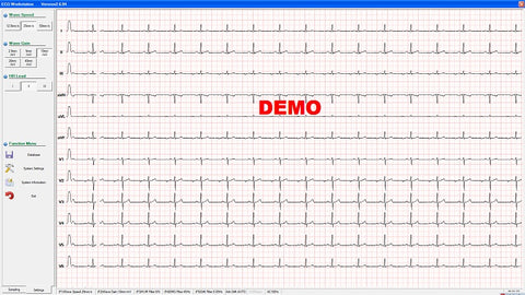 ECG waveform interface after connecting to the workstation