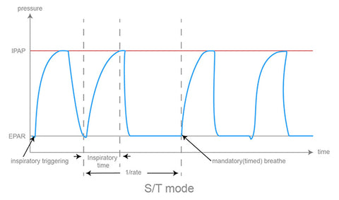 Types of BiPAP machine modes – BMC CPAP Shop
