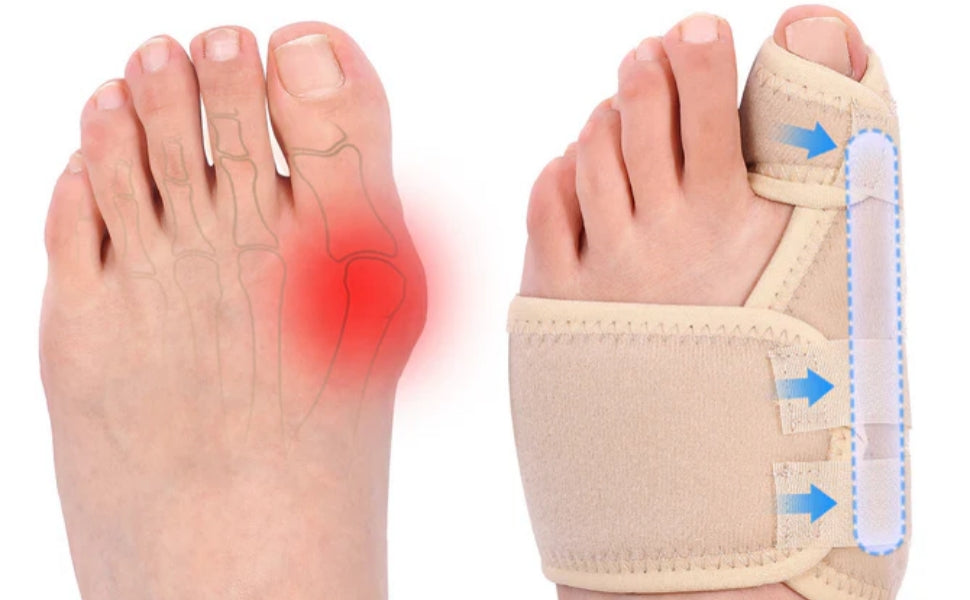 Fivali Bunion Support Brace - Guide