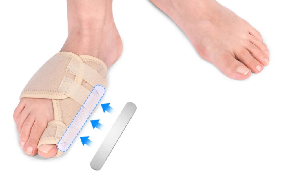 Fivali Bunion Toe Corrector - Guide