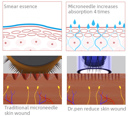 Derma Pen VS Derma Roller