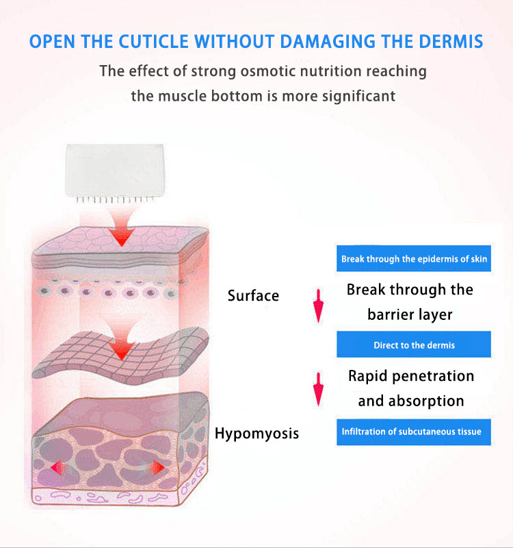 why choose derma pen