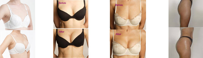 Otesaly Body Filler Before & After