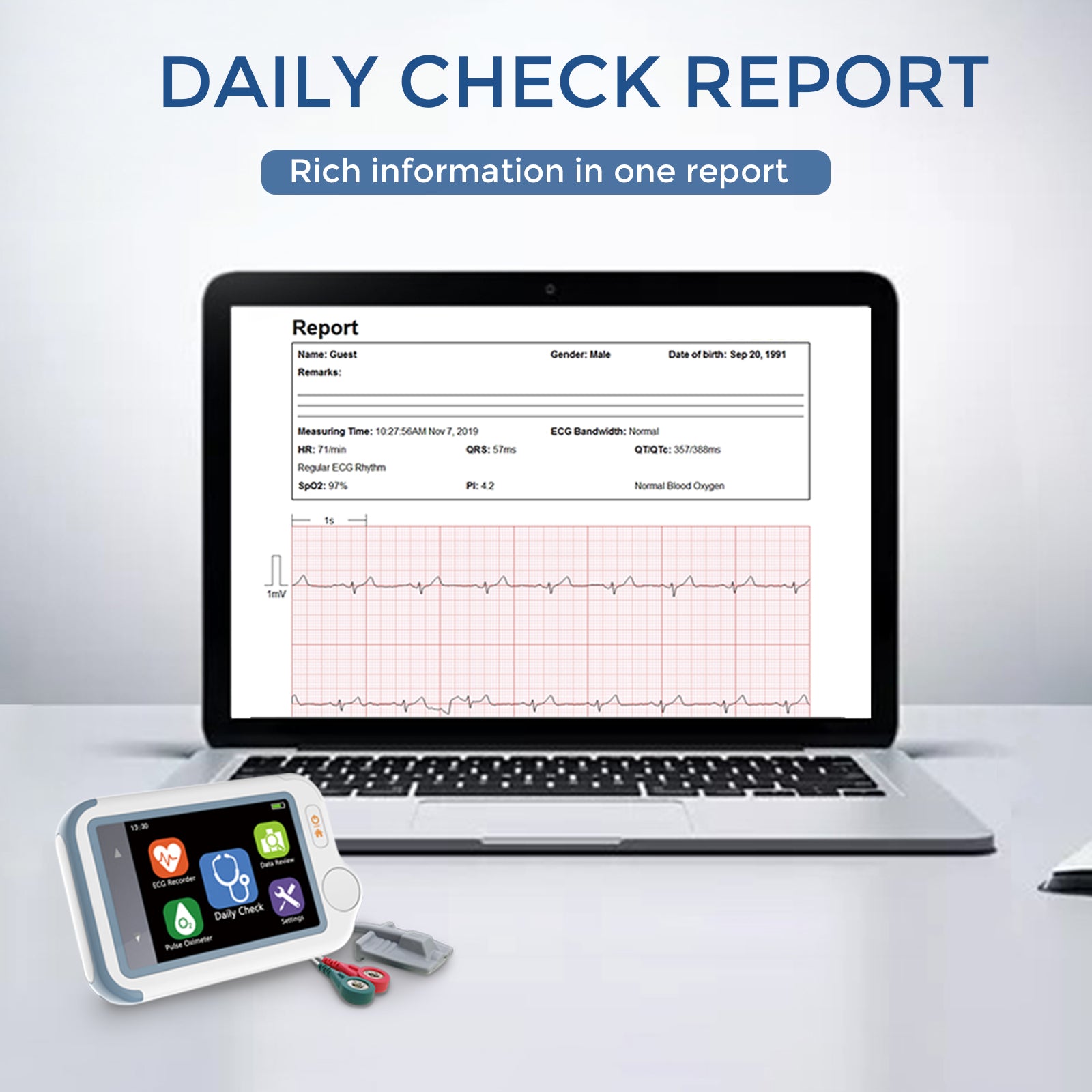 Checkme Lite SpO2 & ECG Monitor