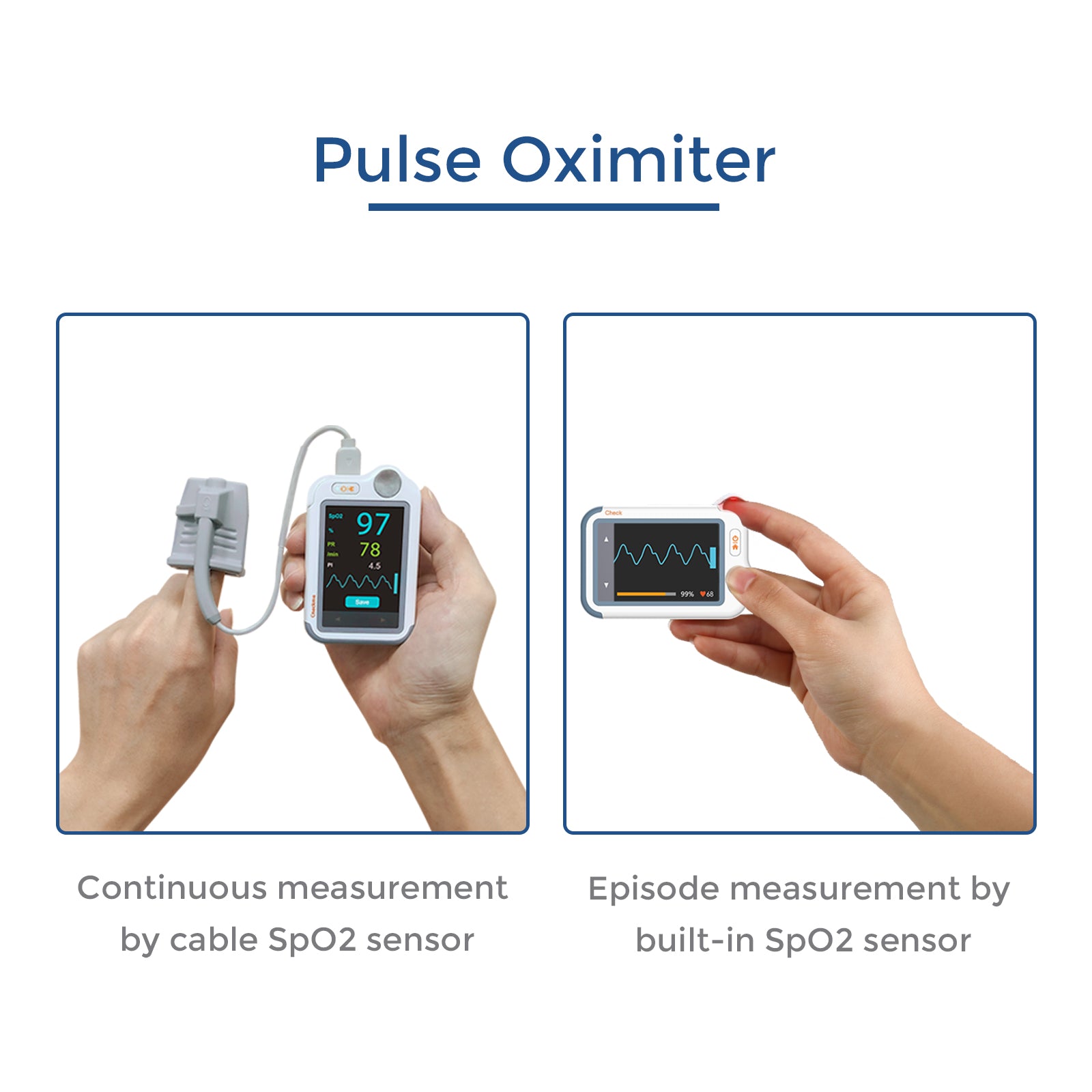 Checkme Lite SpO2 & ECG Monitor