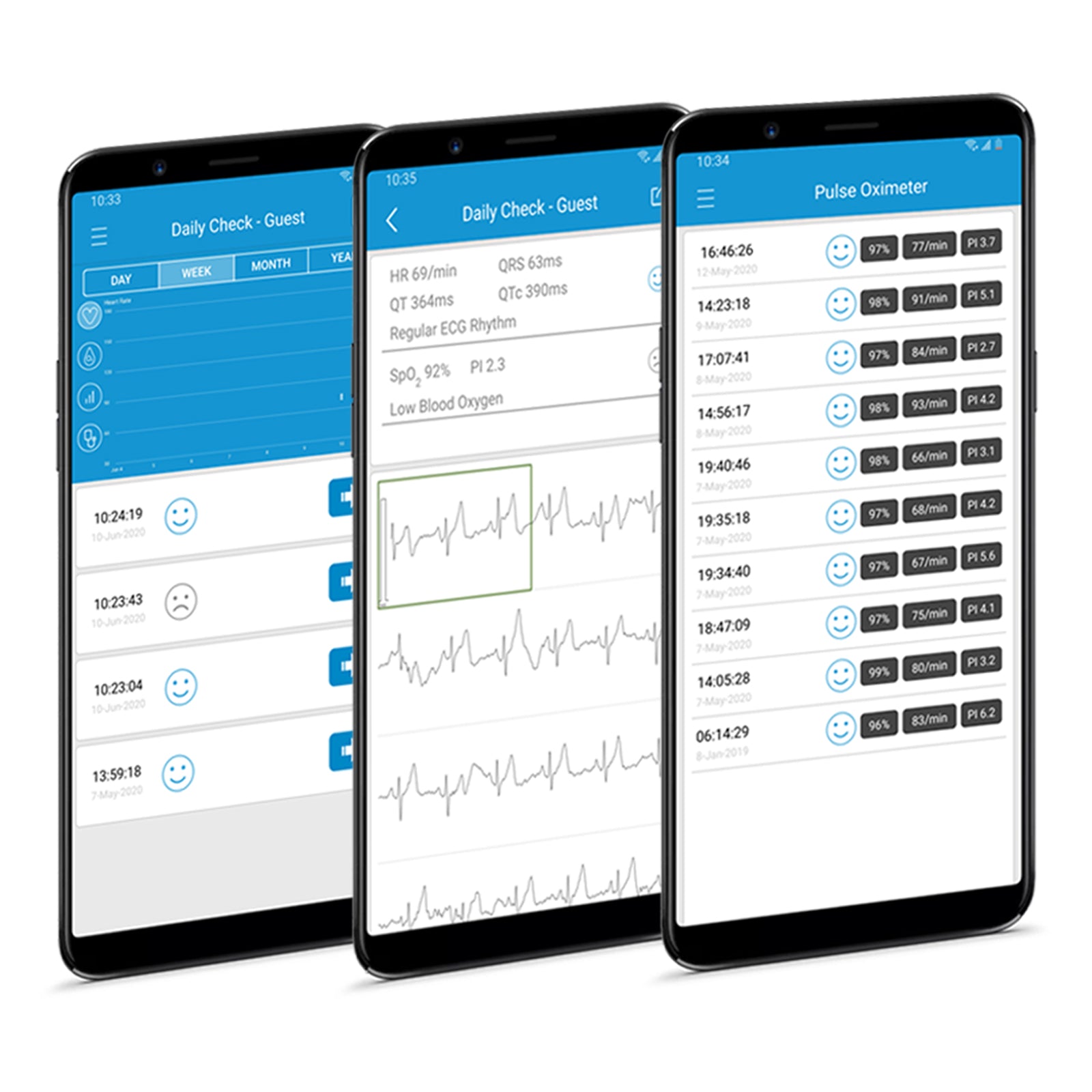 Checkme Lite SpO2 & ECG Monitor