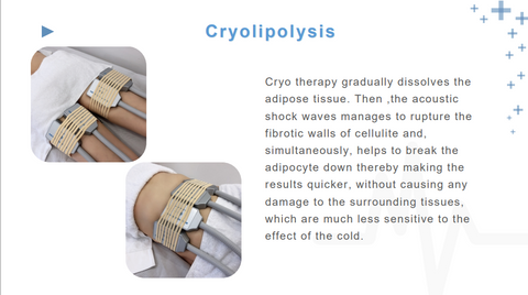 2 in 1 Physical Cryo Reduce Fat Pneumatic Shock Wave Pain Relief Therapy Machine