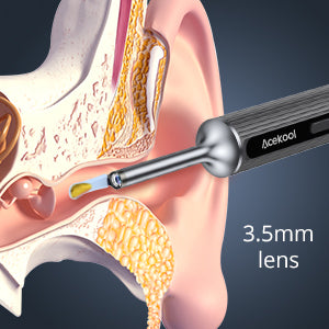 ACEKOOL Ear Wax Removal EV1 with 1080P HD Ear Camera Ear Cleaner ACEKOOL Ear Wax Removal EV1 with 1080P HD Ear Camera Ear Cleaner