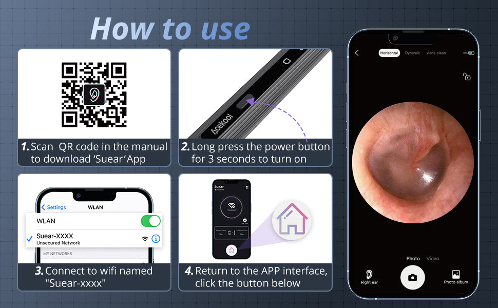 ACEKOOL Ear Wax Removal EV1 with 1080P HD Ear Camera Ear Cleaner ACEKOOL Ear Wax Removal EV1 with 1080P HD Ear Camera Ear Cleaner
