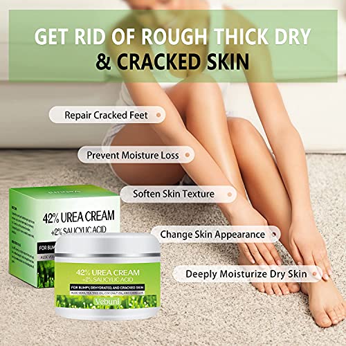 Vebuni Urea Cream 42% Foot Cream Salicylic Acid 4 Oz, Upgraded Callus Remover For Feet, Knees& Elbows, Intensive Moisturizes & Softens Skin, Exfoliates Dead Skin