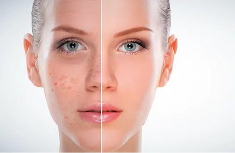 Blue Copper Peptide Hyaluronic Acid Serum