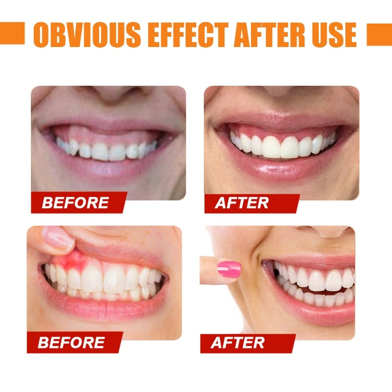 Teeth Whitening Herbal Toothpaste