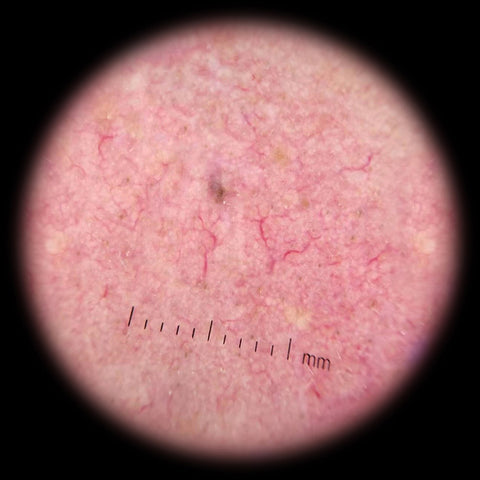 EFEITO DERMATOSCÓPIO IBOOLO DE-300