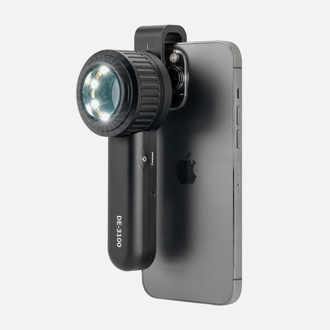 ДЕРМАТОСКОП IBOOLO DE-3100