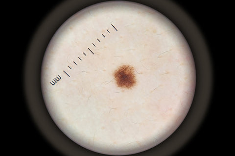 IBOOLO DE-3100 ДЕРМАТОСКОП ЭФФЕКТ