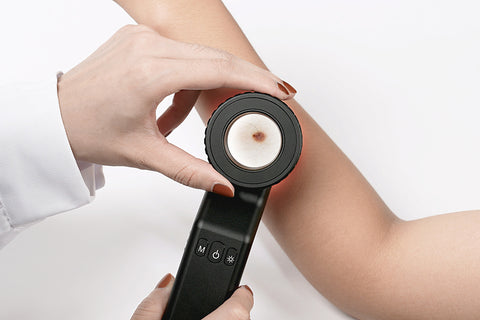 ДЕРМАТОСКОП IBOOLO NAKED EFFECT