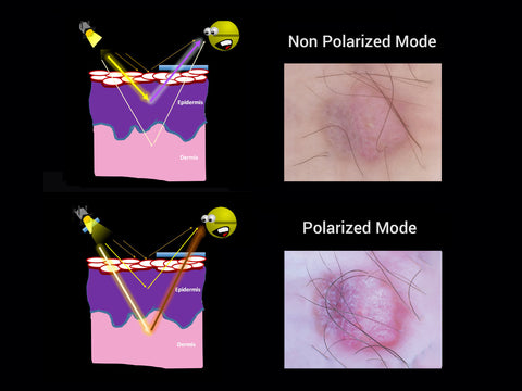 Поляризация и неполяризация