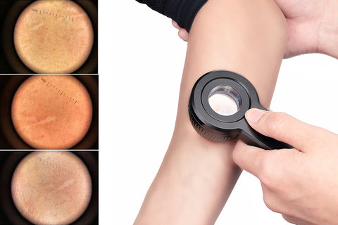 IBOOLO DE-3100 ДЕРМАТОСКОП ЭФФЕКТ