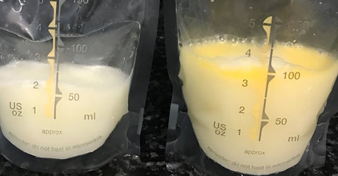 Different colors of breast milk