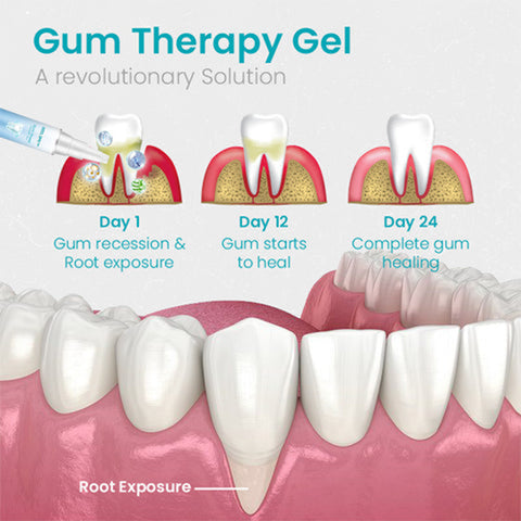 🔥Last Day Promotion 70% OFF🔥--NESLEMY™ Gum Shield Therapy Gel